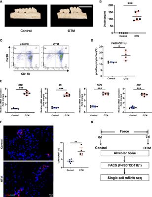 CCR2+ Macrophages Promote Orthodontic Tooth Movement and Alveolar Bone Remodeling